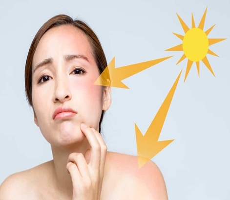 tác hại tia cực tím