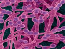 nấm mốc trong nhà