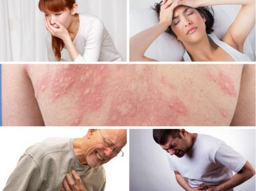 sốc phản vệ sau tiêm vắc xin Covid-19