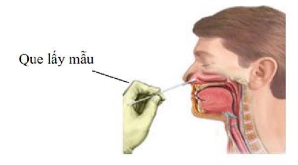 Lấy mẫu dịch mũi