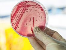 Vi khuẩn coliform