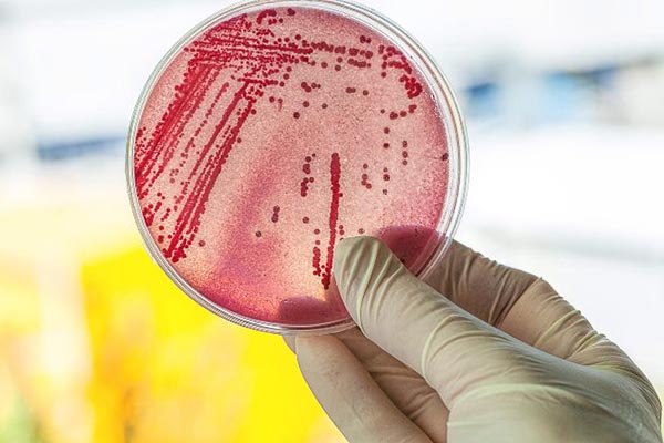 Vi khuẩn coliform