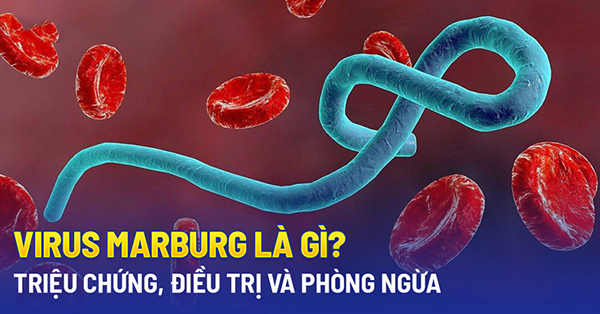 Bệnh do virus Marburg là gì?